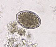 A patient presents to the hospital with complaints of abdominal pain. A stool examination was done, and it showed the presence of the organism shown in image A. The body has segments broader than the length. Which of the eggs shown in column B corresponds to this organism?